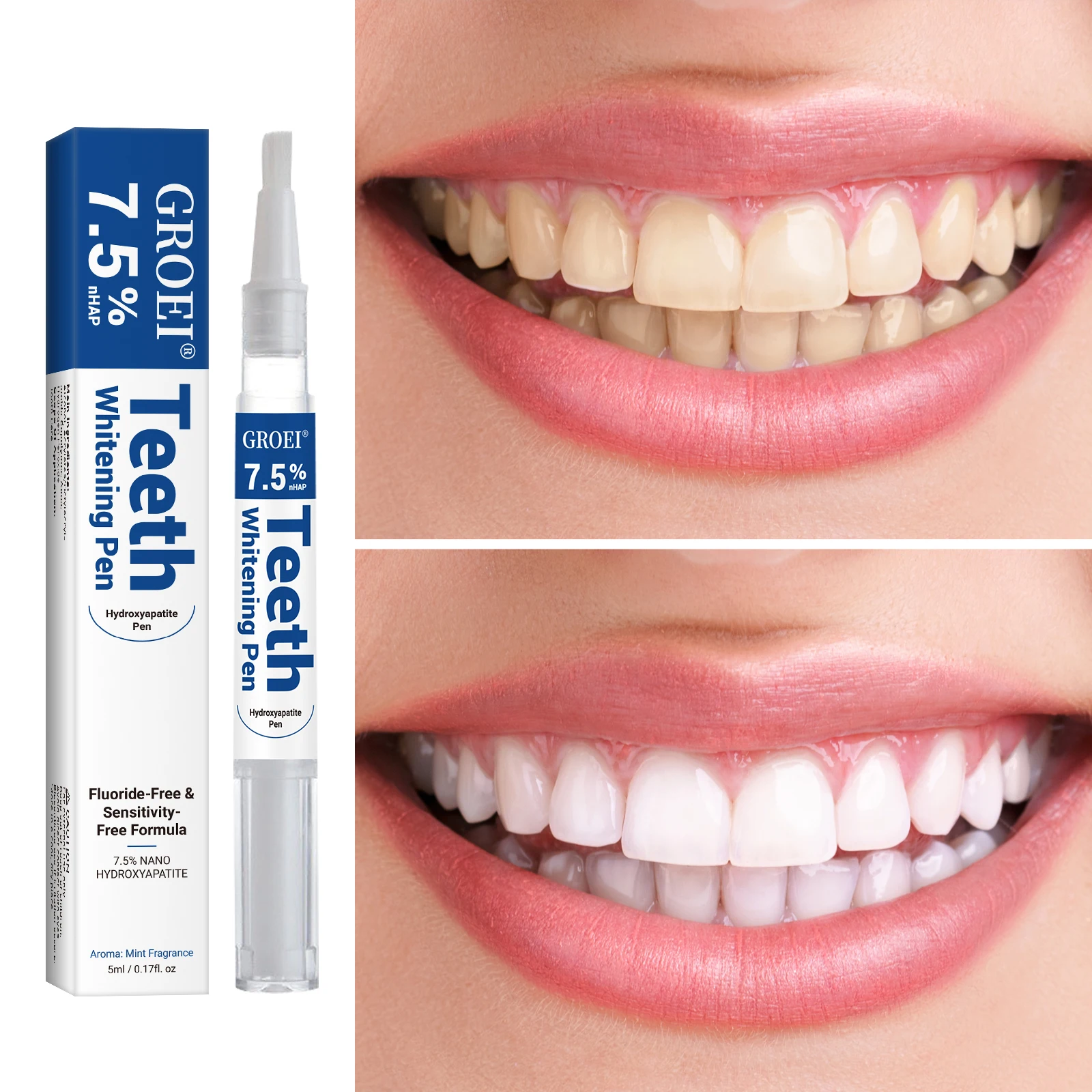 Hydroxyapatite Tooth Whitening - Teeth Whitening Price review and price