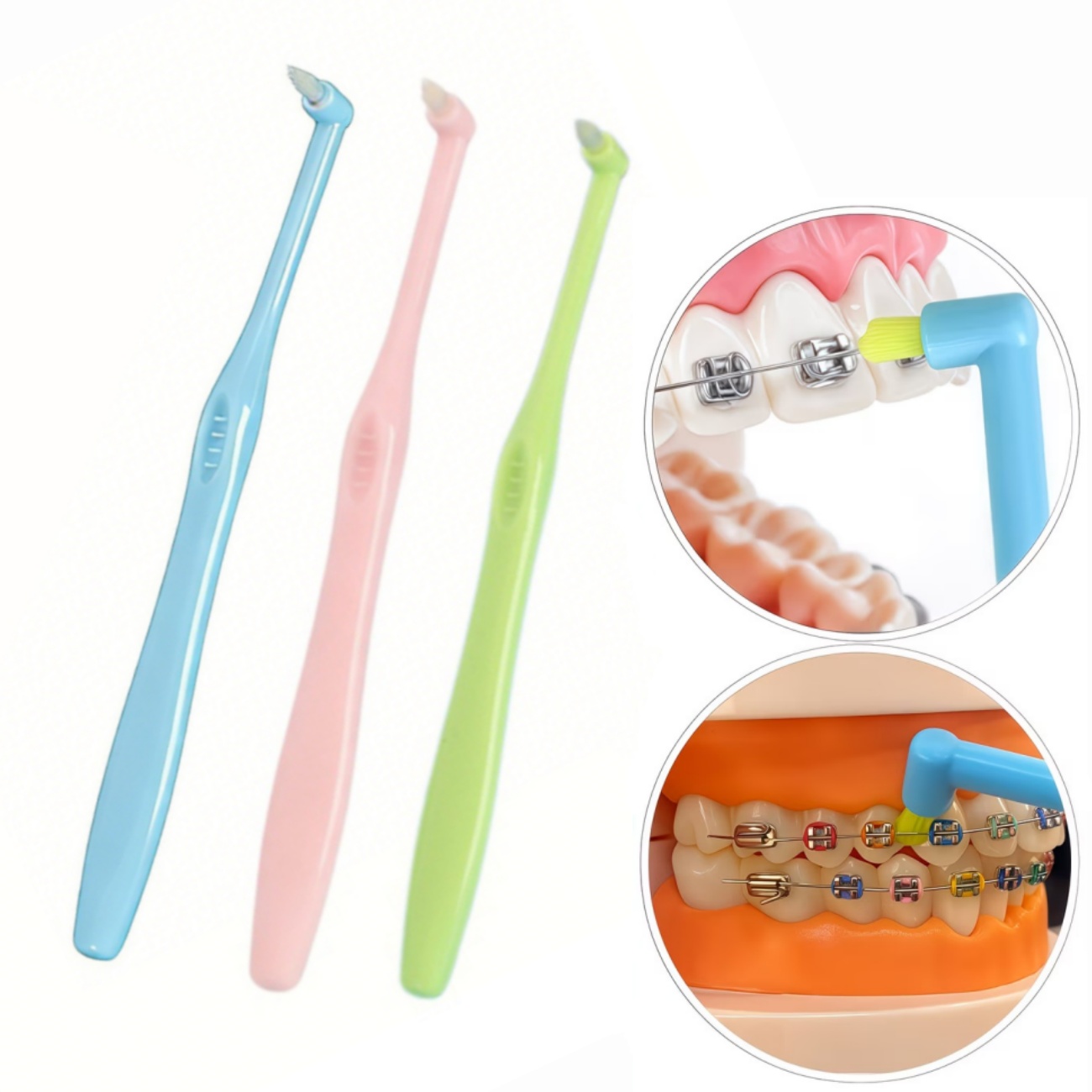 1/3pc Orthodontic Braces Tooth - Teeth Whitening With Braces review and price
