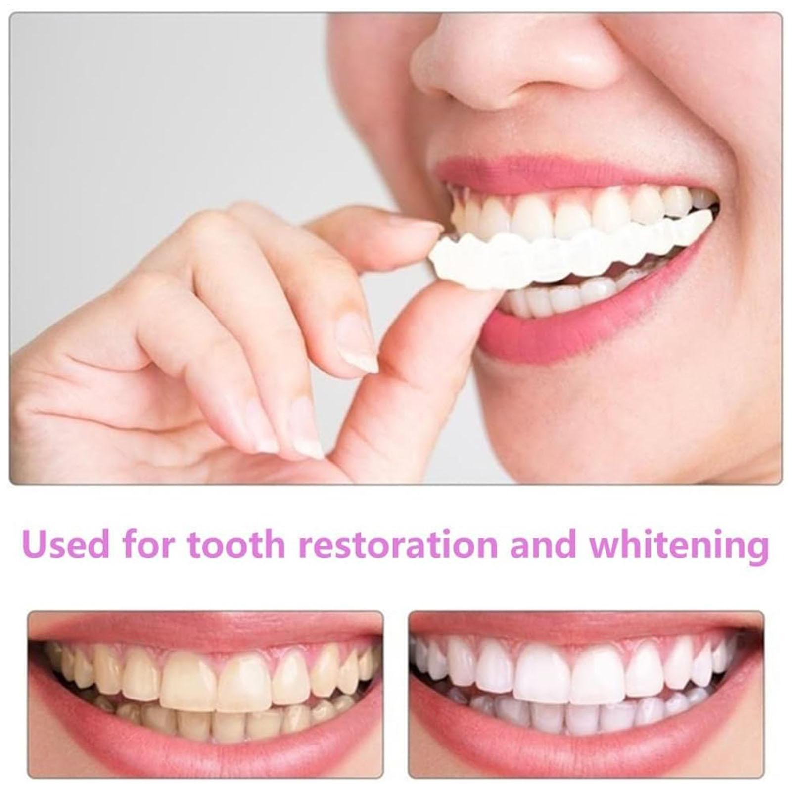 Dental Upper Lower Fake Teeth  - Teeth Whitening With Braces review and price