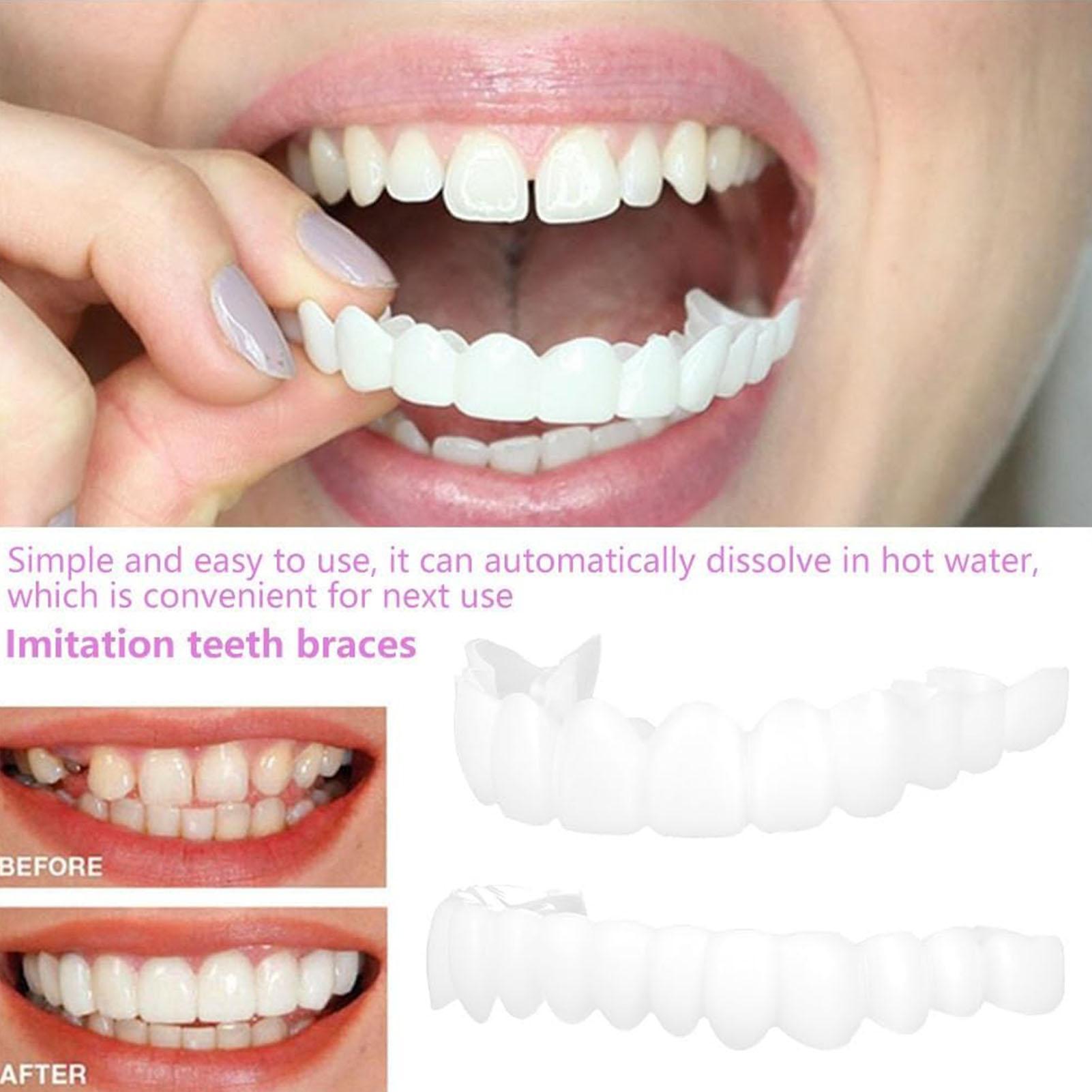 Dental Upper Lower Fake Teeth  - Teeth Whitening With Braces review and price