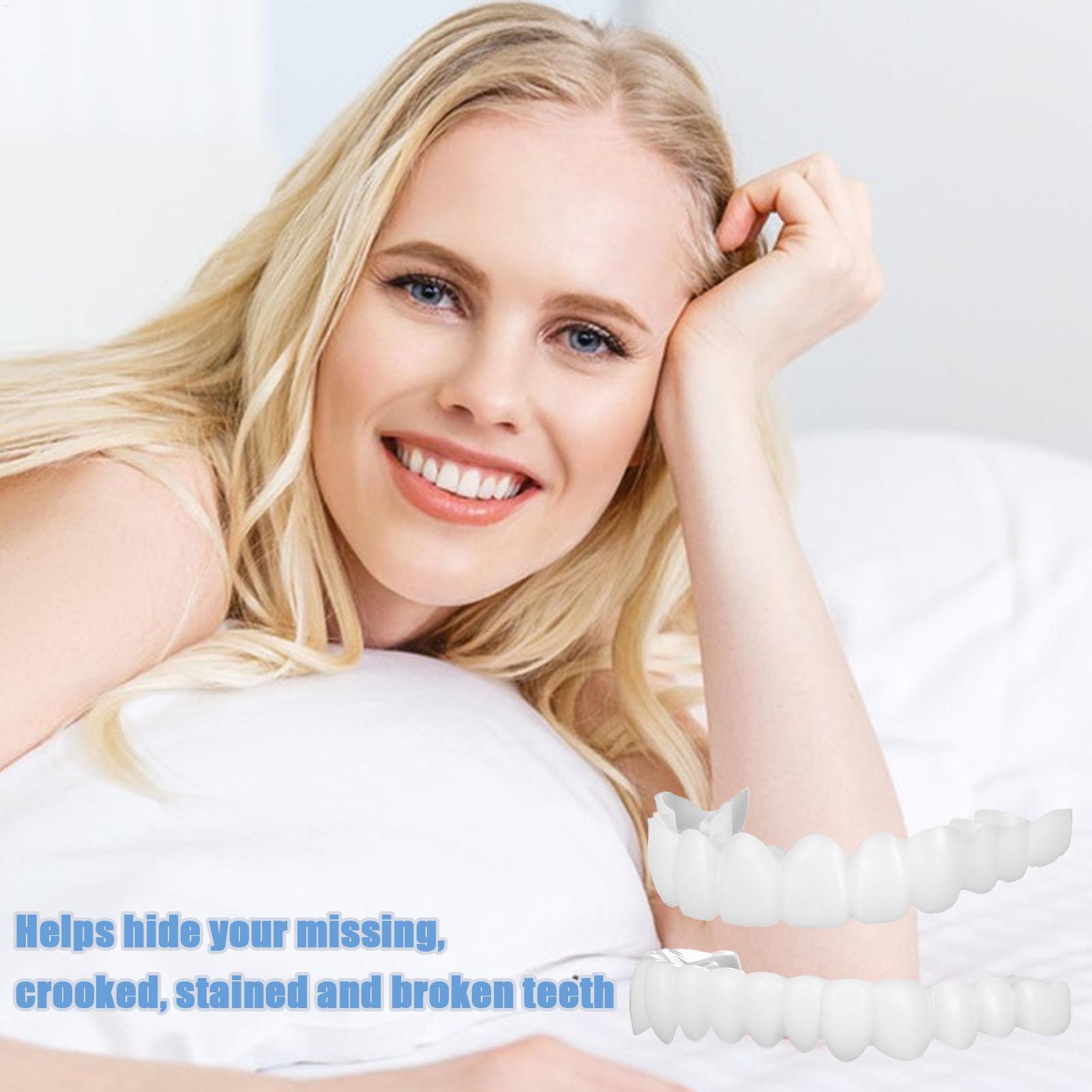 Dental Upper Lower Fake Teeth  - Teeth Whitening With Braces review and price