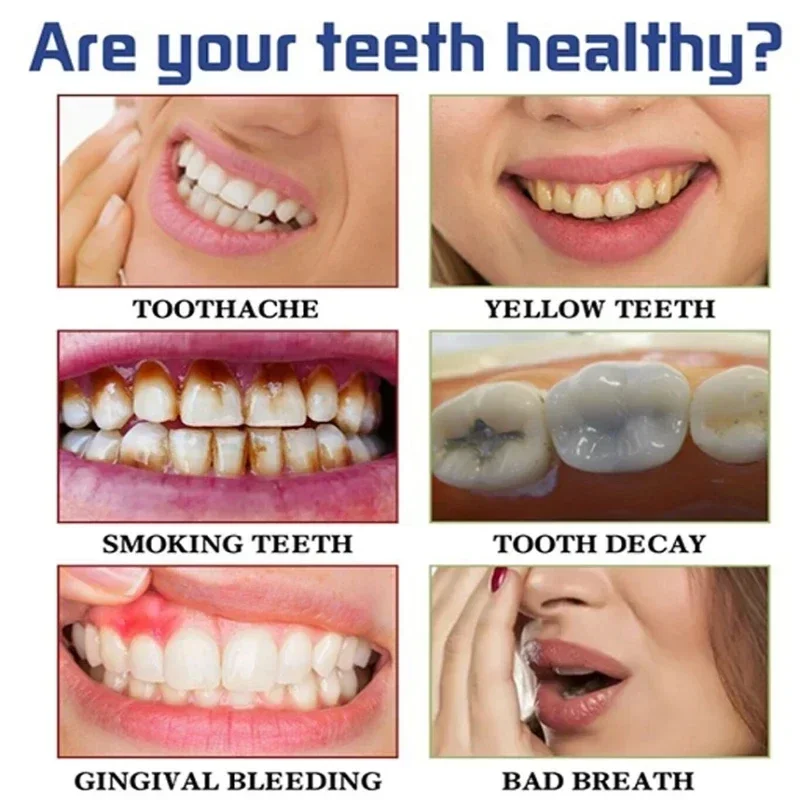 Fast Remove Smoke Stains Tooth - Teeth Whitening Fast review and price