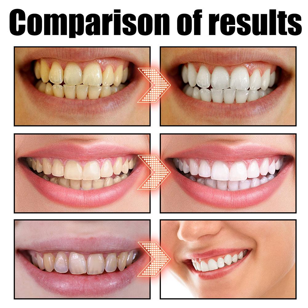 Coconut Mint Pulling Oil Mouth - Teeth Whitening Oil Pulling review and price