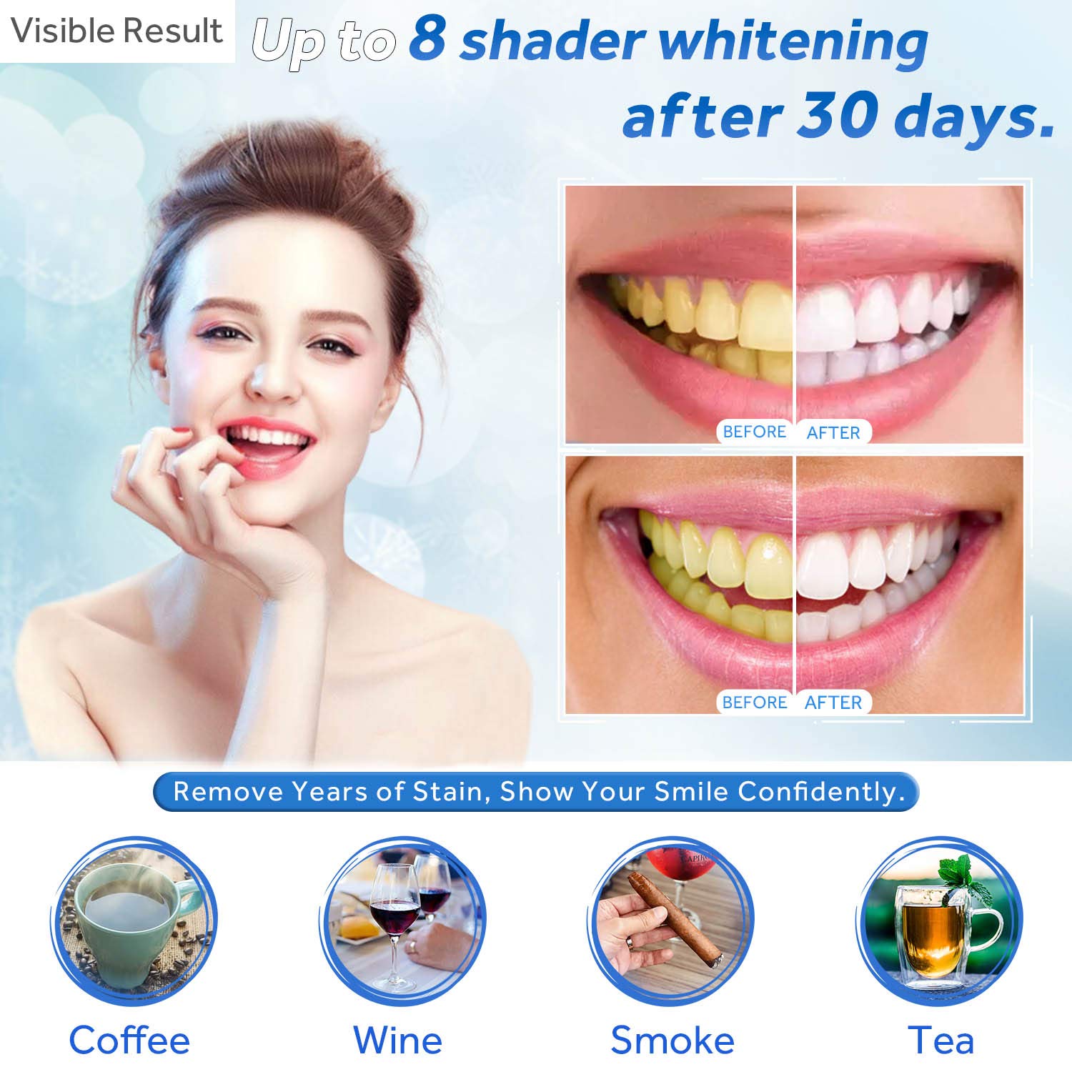 Teeth Whitening Gel Refill Syr - Teeth Whitening Price review and price