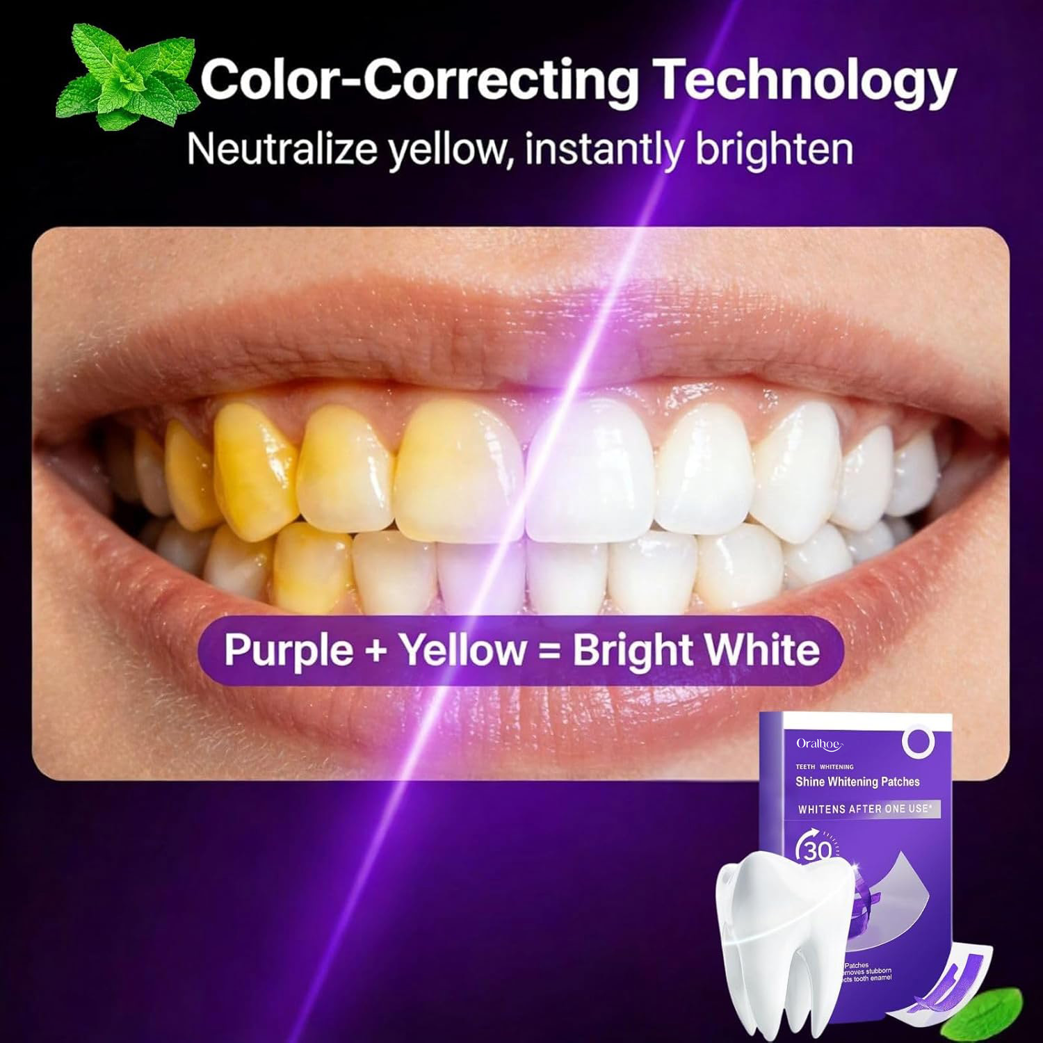 Purple Teeth Whitening Combo K - Teeth Whitening Home Kit review and price