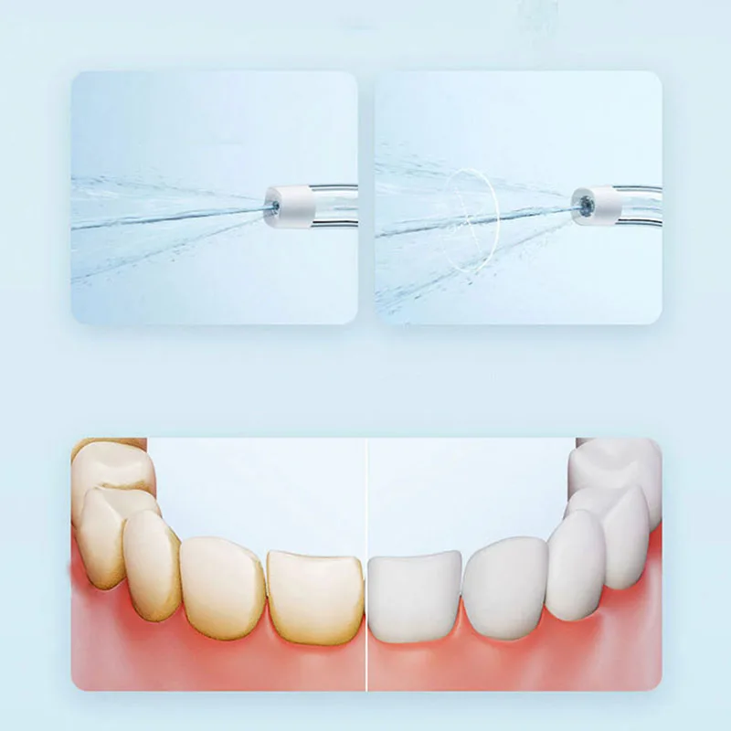 Xiaomi Portable Oral Irrigator - Teeth Whitening Quick review and price
