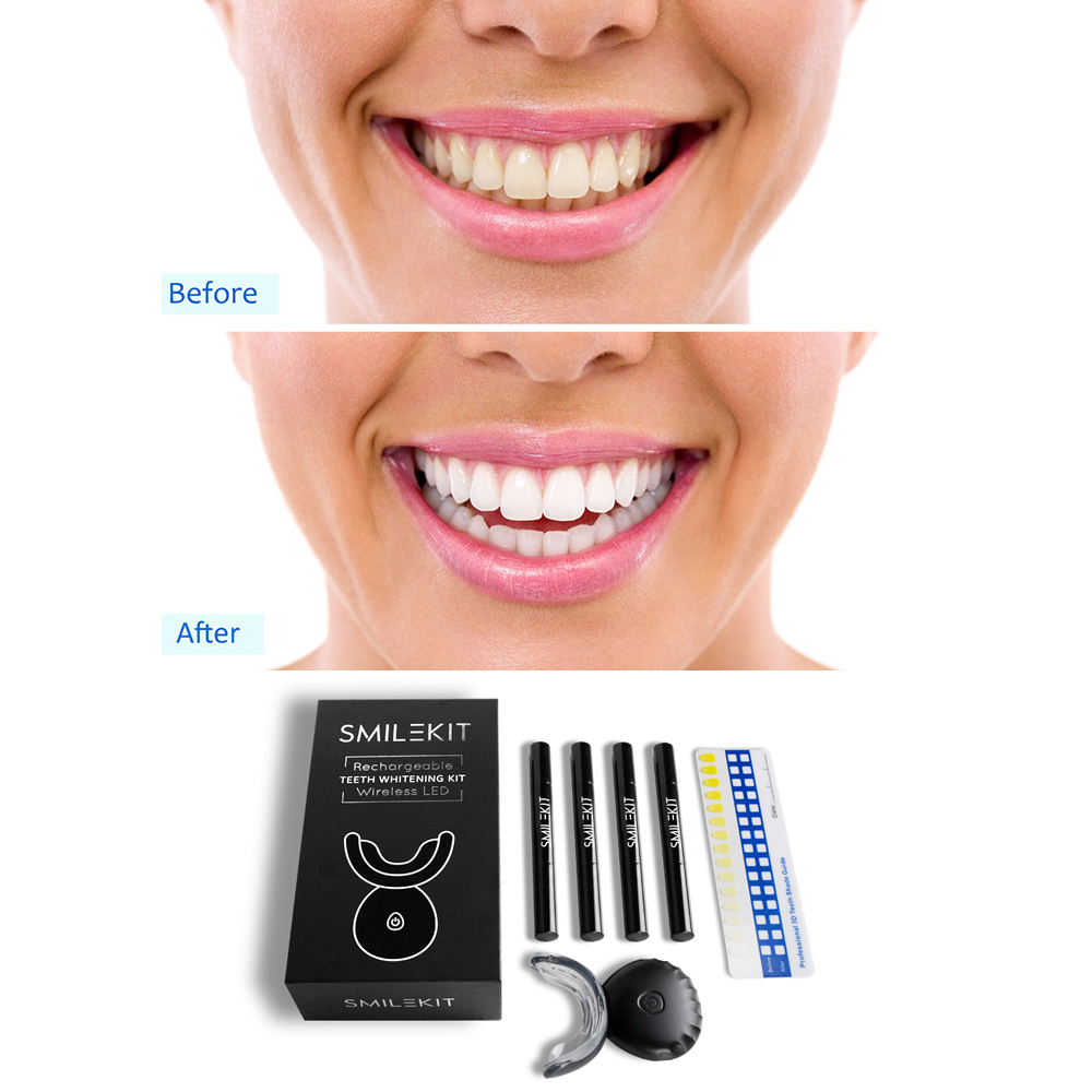 New Electric Teeth Whitening L - Teeth Whitening Home Kit review and price