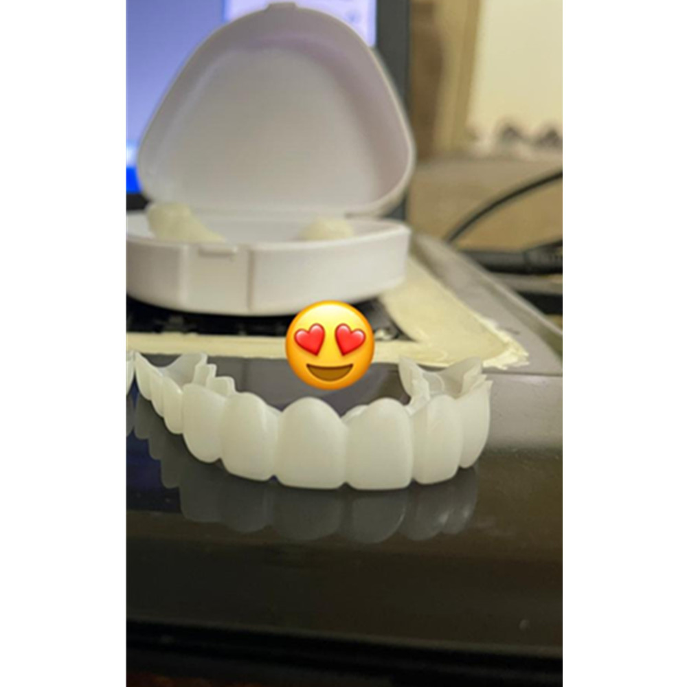 On Smile Dental Upper Lower Fa - Teeth Whitening With Braces review and price